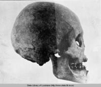 Skull excavated from Crooks Site in LaSalle Parish Louisiana